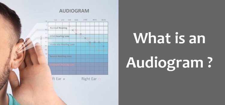 What is an Audiogram?